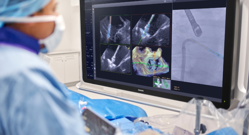 FDA OKs Philips’ DeviceGuide for Heart Valve Repair Guidance